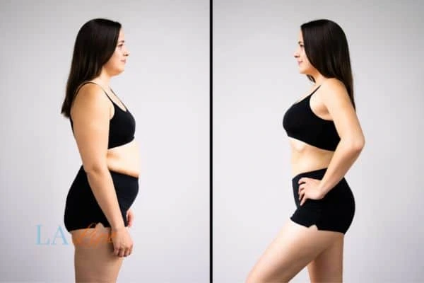 LA-EMS Body Sculpting Old Oak Common results before and after of womans results on body toning.