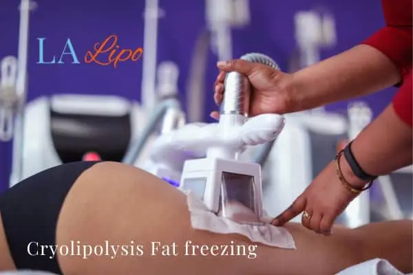 women getting fat freezing Old Oak Common