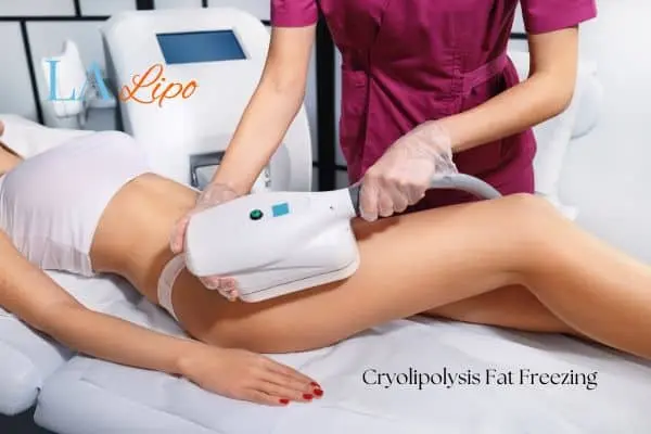 Woman receiving coolsculpting Old Oak Common treatment on her thighs