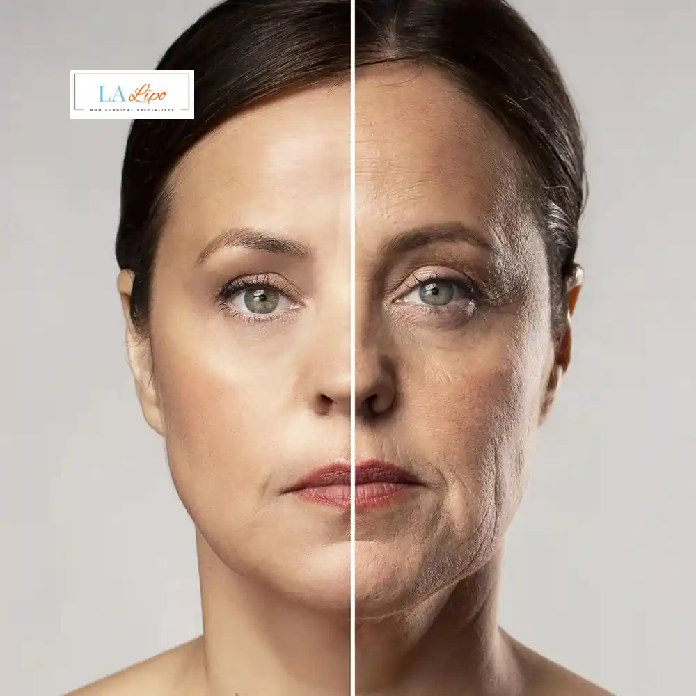 How Can You Tell If Non-Surgical Skin Tightening Is Right for You Old Oak Common?