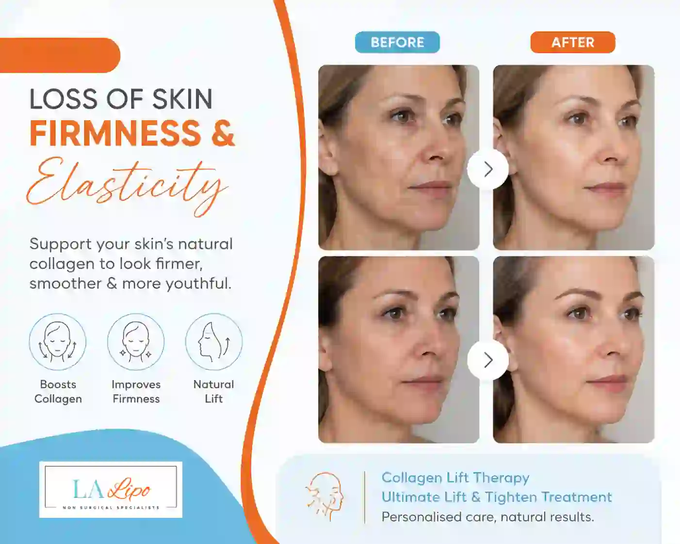 Sign #7: Loss of Skin Firmness and Elasticity Old Oak Common